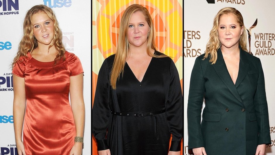 Amy Schumer's Dramatic Weight Loss Stuns Fans, Here's What She Revealed